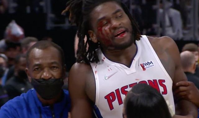 开云kaiyun网页版-向詹姆斯发起癫狂的冲刺 斯图尔特真是个恶棍吗？